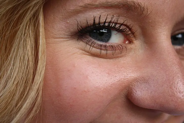 Dry Skin